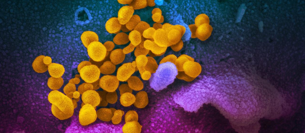 scanning electron microscope image shows SARS-CoV-2 (yellow)—also known as 2019-nCoV, the virus that causes COVID-19—isolated from a patient in the U.S., emerging from the surface of cells (blue/pink) cultured in the lab.  source us national institutes of health 
