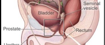 Bladder diagram