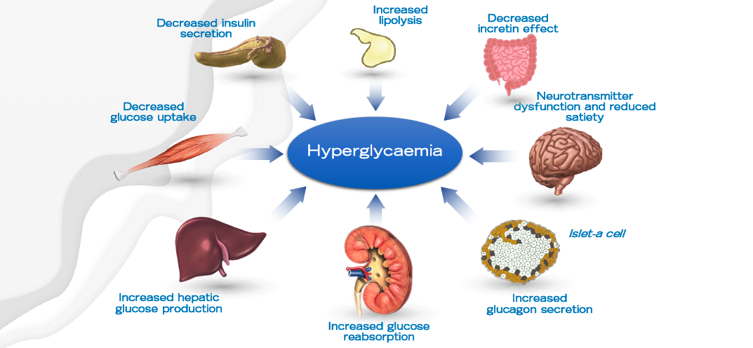 Webinar 1 Hyperglycaemia