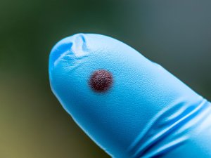 Blood-on-gloved-finger